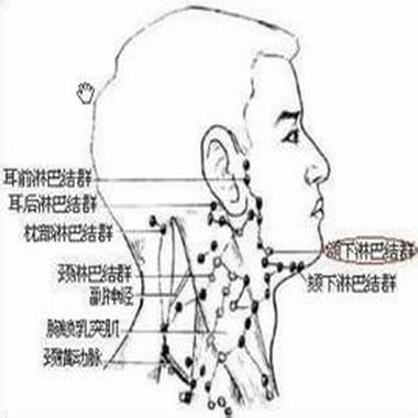 脖子淋巴癌早期症状图片视频,脖子淋巴癌早期症状解析，图片、视频与实时解答指南,功能性操作方案制定_Executive99.66.67