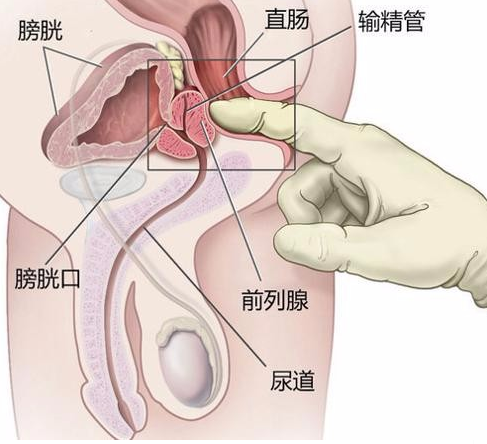 前列腺炎有什么症状和危害性