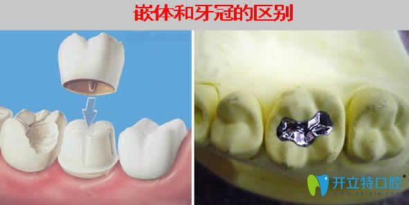 牙齿治疗一般多少钱,牙齿治疗费用解析，科学分析、专业说明,全面应用分析数据_The37.83.49