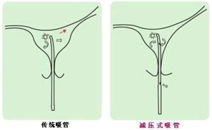 微管无痛人流要做多久