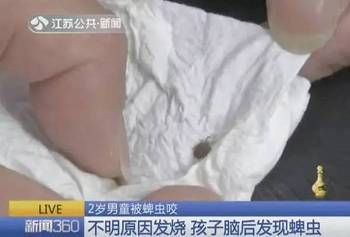 2岁男童发烧确诊甲状腺结节4级